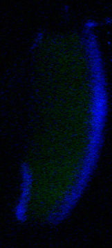 humeur aqueuse de l'œil fluorescente