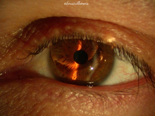 lentille de contact dure