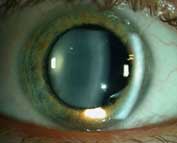 lien vers photos ophtalmologie