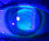 lien vers lentille de contact flexible