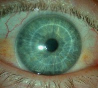 lien vers lentille de contact souple