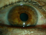 lien vers yeux vairons